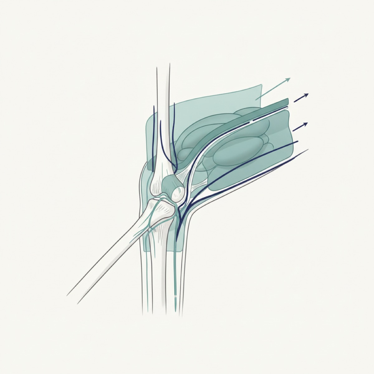 How does fascia release alleviate low back pain?