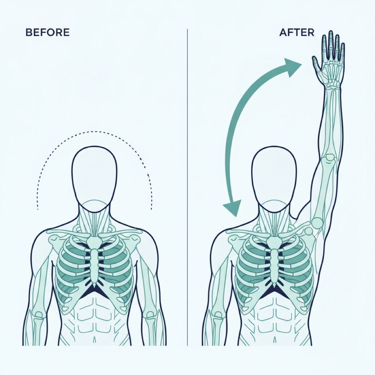 What to expect from fascia release therapy?