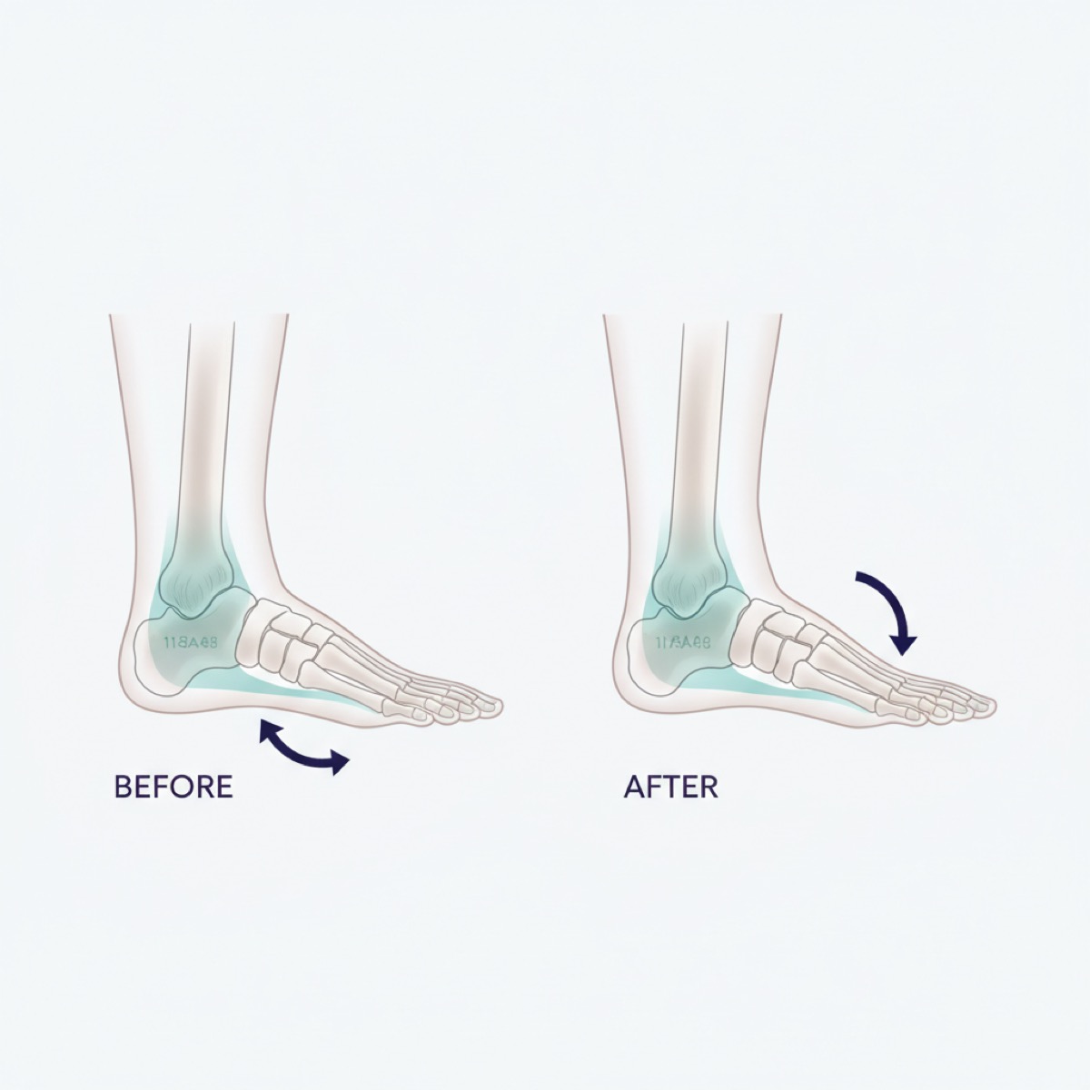 What results can you expect from fascia release?