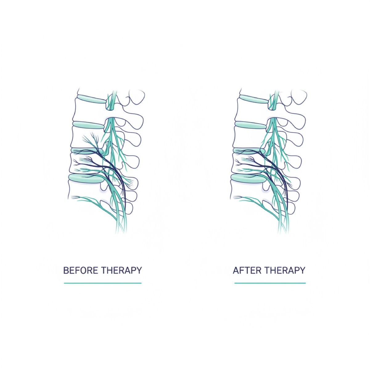 How effective is fascia release for long-term relief?